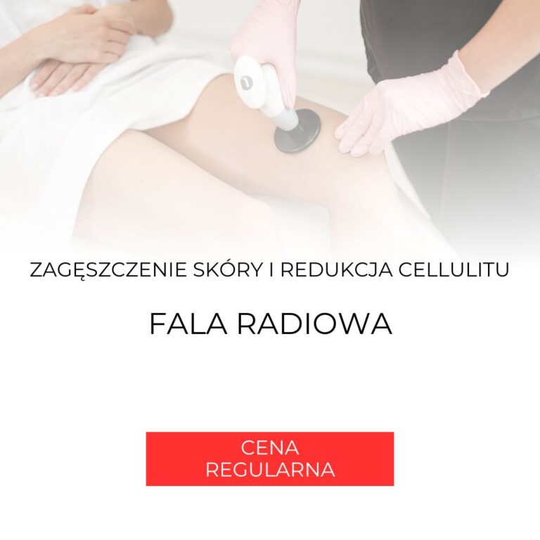 Zdjęcie produktu NuEra Fala Radiowa Focus RF – Ciało