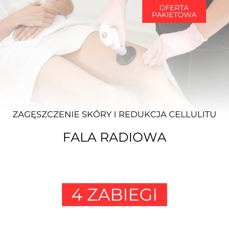 Zdjęcie produktu NuEra Fala Radiowa Focus RF – Ciało – Pakiet 4 zabiegi