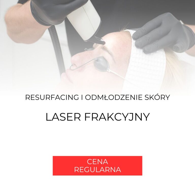 Zdjęcie produktu Laser Frakcyjny Frax 1550 – Nieablacyjny – Resurfacing